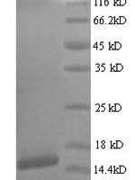 Human papillomavirus type 18 Protein E7 (E7) Recombinant Protein, N-His, aa 1–105, Yeast - BioCrest Sci