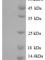 Human Elongation factor 2 (EEF2) Recombinant Protein, N-His, aa 2–858, E.coli - BioCrest Sci
