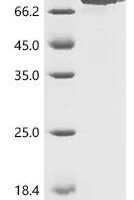 Human Biotin--protein ligase (HLCS) Recombinant Protein - BioCrest Sci