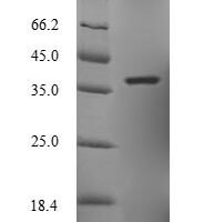 Zaire ebolavirus Transcriptional activator VP30 (VP30) Recombinant Protein, N-His, aa 1–288, E.coli - BioCrest Sci