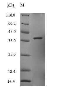Zaire ebolavirus Transcriptional activator VP30 (VP30) Recombinant Protein, N-His, aa 1–288, E.coli, Zaire ebolavirus (strain Kikwit-95) (ZEBOV) (Zaire Ebola virus), E.coli, N-terminal 6xHis-tagged, 38.0 kDa, purity >≥ 90% as determined by SDS-PAGE.