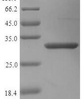 Human Mimecan (OGN) Recombinant Protein, N-His, aa 21–298, Yeast - BioCrest Sci