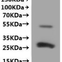 Mouse CD9 antigen  (Cd9)-VLPs Recombinant Protein - BioCrest Sci