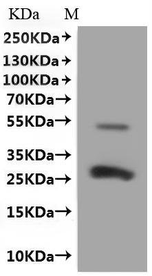 Mouse CD9 antigen (Cd9)-VLPs Recombinant Protein, Mus musculus (Mouse), Mammalian cell, C-terminal 10xHis-tagged, 26.6 kDa, purity >The purity information is not available for VLPs proteins.