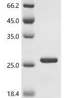 Mouse Basic leucine zipper transcriptional factor ATF-like (Batf) Recombinant Protein - BioCrest Sci