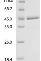 Human Retinoic acid receptor responder protein 2 (RARRES2) Recombinant Protein, C-hFc1 - BioCrest Sci