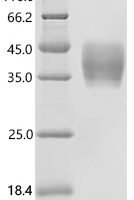 Human OX-2 membrane glycoprotein (CD200), partial Recombinant Protein - BioCrest Sci