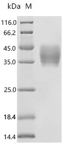 Human OX-2 membrane glycoprotein (CD200), partial Recombinant Protein, Homo sapiens (Human), Mammalian cell, C-terminal 10xHis-tagged, 23.8 kDa, purity >≥ 95% as determined by SDS-PAGE.