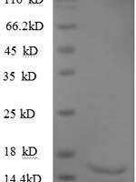Human Transforming growth factor beta-3 proprotein (TGFB3), partial Recombinant Protein, N-His - BioCrest Sci