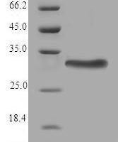 Human Thioredoxin-related transmembrane protein 2 (TMX2), partial Recombinant Protein - BioCrest Sci