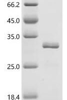 Mouse Nitric oxide synthase, endothelial (Nos3), partial Recombinant Protein - BioCrest Sci