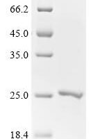 Human Focadhesin (FOCAD), partial Recombinant Protein, C-His - BioCrest Sci