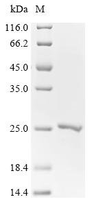 Human Focadhesin (FOCAD), partial Recombinant Protein, C-His, Homo sapiens (Human), E.coli, C-terminal 6xHis-tagged, 23.7 kDa, purity >≥ 90% as determined by SDS-PAGE.