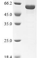 Bovine Retinal dehydrogenase 1 (ALDH1A1) Recombinant Protein - BioCrest Sci