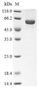 Bovine Retinal dehydrogenase 1 (ALDH1A1) Recombinant Protein, Bos taurus (Bovine), E.coli, N-terminal 10xHis-tagged and C-terminal Myc-tagged, 62.1 kDa, purity >≥ 85% as determined by SDS-PAGE.