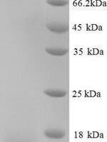 Human Guanylate cyclase activator 2B (GUCA2B) Recombinant Protein, N-His, aa 27–112, Yeast - BioCrest Sci