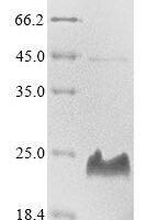 Toxoplasma gondii Dense granule protein 3 (GRA3), partial Recombinant Protein - BioCrest Sci