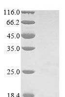 Human Lysophosphatidic acid receptor 3 (LPAR3), partial Recombinant Protein - BioCrest Sci