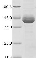 Epstein-Barr virus Replication and transcription activator (BRLF1), partial Recombinant Protein - BioCrest Sci