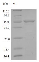 Rat Matrilysin (Mmp7) Recombinant Protein, N-GST - BioCrest Sci