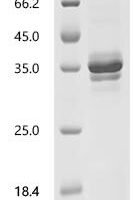 Mouse C-type natriuretic peptide (Nppc) Recombinant Protein, N-hFc1 - BioCrest Sci