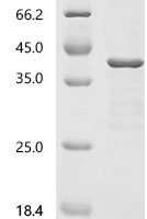 Human Collagenase 3 (MMP13), partial Recombinant Protein - BioCrest Sci