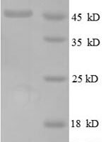 Escherichia coli 50S ribosomal protein L6 (rplF), partial Recombinant Protein - BioCrest Sci