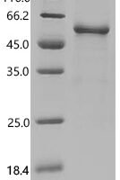 Macaca fascicularis Interferon beta (IFNB1) Recombinant Protein, C-hFc1 - BioCrest Sci