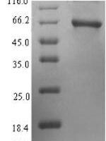 Human Protoporphyrinogen oxidase (PPOX) Recombinant Protein - BioCrest Sci