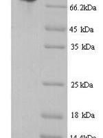 Mouse Transcriptional repressor CTCFL (Ctcfl) Recombinant Protein, N-His - BioCrest Sci