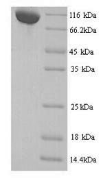 Mouse Transcriptional repressor CTCFL (Ctcfl) Recombinant Protein, N-His, Mus musculus (Mouse), Yeast, N-terminal 6xHis-tagged, 75.1 kDa, purity >≥ 90% as determined by SDS-PAGE.