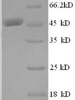 Human Histone acetyltransferase MYST2 (KAT7), partial Recombinant Protein - BioCrest Sci