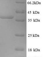 Mouse Microtubule-associated protein 2 (Map2), partial Recombinant Protein, N-His - BioCrest Sci