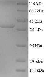 Mouse Microtubule-associated protein 2 (Map2), partial Recombinant Protein, N-His, Mus musculus (Mouse), Yeast, N-terminal 6xHis-tagged, 40.0 kDa, purity >≥ 90% as determined by SDS-PAGE.
