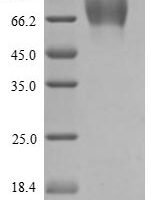 Rat Heat-stable enterotoxin receptor (Gucy2c), partial Recombinant Protein, N-His/C-Myc, aa 23–429, Yeast - BioCrest Sci