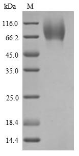 Rat Heat-stable enterotoxin receptor (Gucy2c), partial Recombinant Protein, N-His/C-Myc, aa 23–429, Yeast, Rattus norvegicus (Rat), Yeast, N-terminal 6xHis-tagged and C-terminal Myc-tagged, 49.9 kDa, purity >≥ 90% as determined by SDS-PAGE.