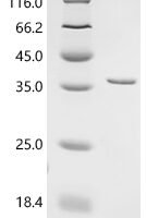 Mycobacterium tuberculosis Protein grpE (grpE) Recombinant Protein, N-10His/C-Myc - BioCrest Sci