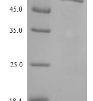 Human Lysosomal acid glucosylceramidase (GBA1) Recombinant Protein, Tag-Free - BioCrest Sci