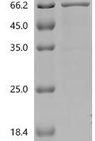 Mouse Angiopoietin-related protein 2 (Angptl2) Recombinant Protein, C-10His-HSA - BioCrest Sci