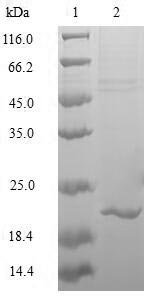 Human Transcription factor MafK (MAFK) Recombinant Protein, Homo sapiens (Human), Baculovirus, N-terminal 10xHis-tagged and C-terminal Myc-tagged, 21.5 kDa, purity >≥ 85% as determined by SDS-PAGE.