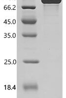 Human Fibroblast growth factor receptor 4 (FGFR4), partial Recombinant Protein - BioCrest Sci