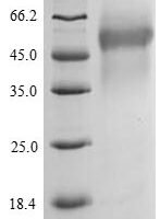 Salmonella typhimurium Protein PrgJ (prgJ) Recombinant Protein - BioCrest Sci