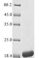 Human HEAT repeat-containing protein 6 (HEATR6), partial Recombinant Protein - BioCrest Sci