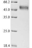 Human Carboxypeptidase N catalytic chain (CPN1) Recombinant Protein, C-His-Myc - BioCrest Sci