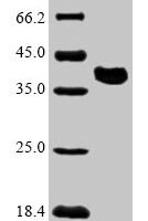 Zaire ebolavirus Polymerase cofactor VP35 (VP35) Recombinant Protein, N-10His/C-Myc, aa 1–340, Mammalian cell - BioCrest Sci