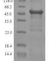 Human Zinc finger Ran-binding domain-containing protein 2 (ZRANB2) Recombinant Protein - BioCrest Sci