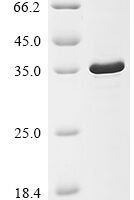 Human T-cell leukemia virus 1 HTLV-1 basic zipper factor (HBZ) Recombinant Protein - BioCrest Sci