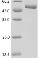 Human Urokinase-type plasminogen activator (PLAU), Biotinylated Recombinant Protein - BioCrest Sci
