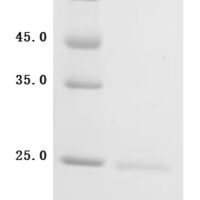 Human Sodium-dependent phosphate transport protein 2B (SLC34A2), partial Recombinant Protein, C-His, aa 234–362 - BioCrest Sci
