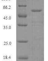 Human Histidine--tRNA ligase, cytoplasmic (HARS1), partial Recombinant Protein - BioCrest Sci